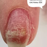 Студия восстановления стоп и ногтей Подолог_Новокуйбышевск фото 3